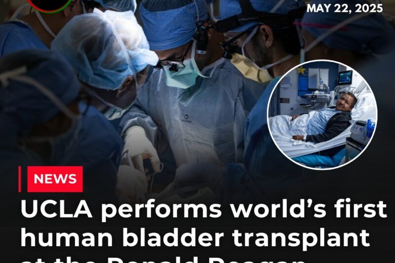 UCLA Achieves Groundbreaking Milestone with First Human Bladder Transplant