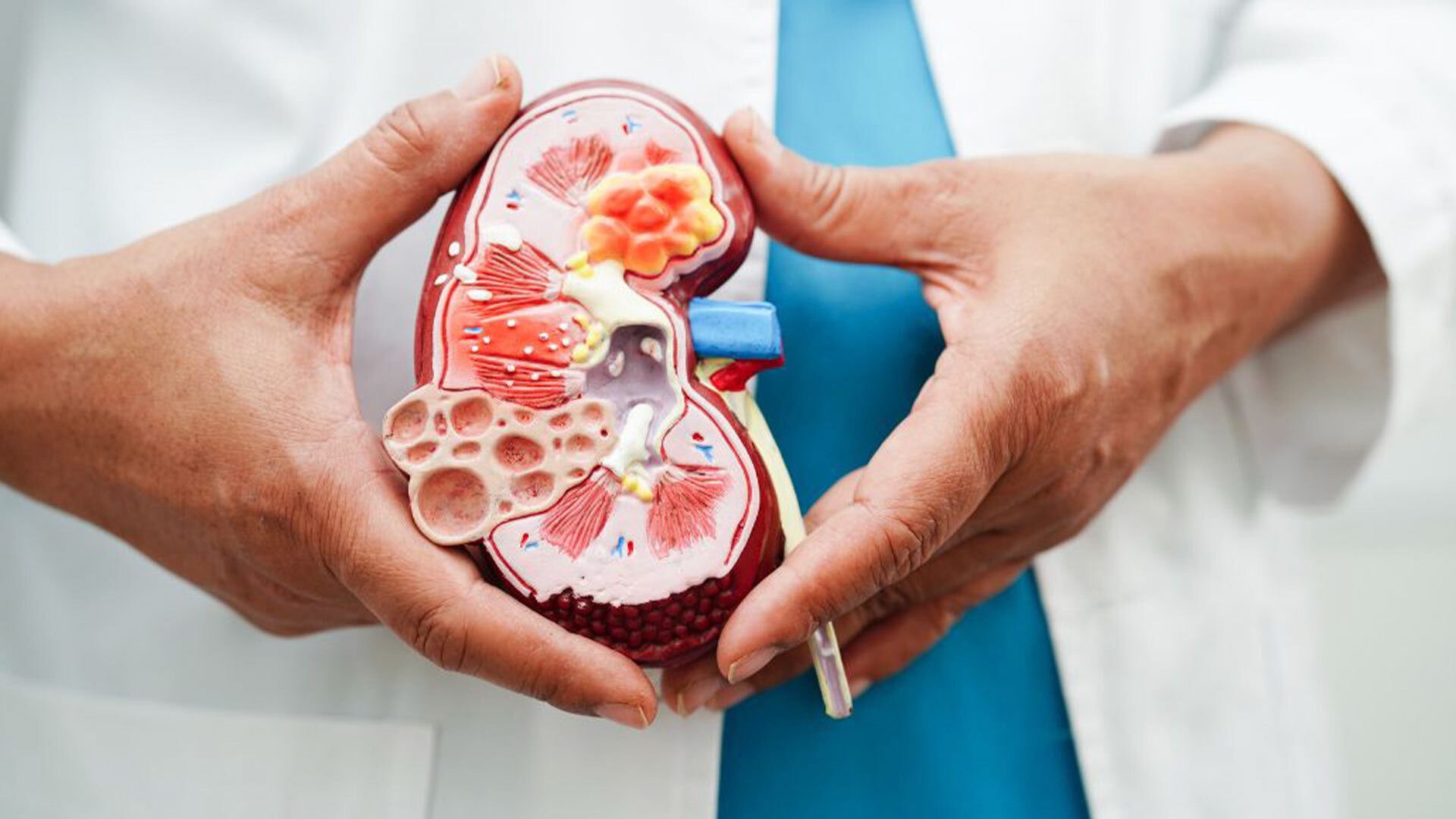 World Kidney Cancer Day 20 June 2025